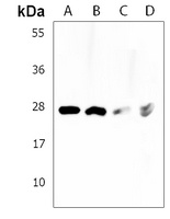 PCGF1 Rabbit Polyclonal Antibody