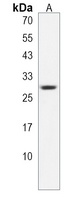 COX11 Rabbit Polyclonal Antibody