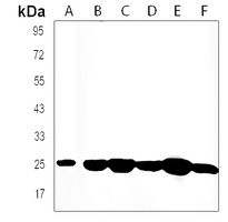 FGF8 Rabbit Polyclonal Antibody