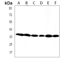 CBX7 Rabbit Polyclonal Antibody