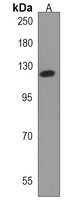 PRDM16 Rabbit Polyclonal Antibody