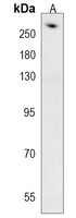 AHCTF1 Rabbit Polyclonal Antibody