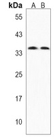 KCTD4 Rabbit Polyclonal Antibody