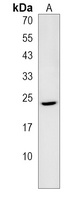 IZUMO2 Rabbit Polyclonal Antibody