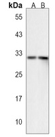 XAF1 Rabbit Polyclonal Antibody