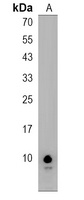 GNGT1 Rabbit Polyclonal Antibody