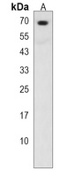SMARCD3 Rabbit Polyclonal Antibody