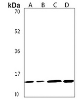 NDUFB4 Rabbit Polyclonal Antibody