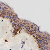 NDUFB4 Rabbit Polyclonal Antibody