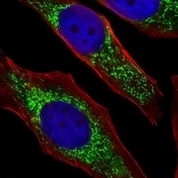 NDUFB4 Rabbit Polyclonal Antibody