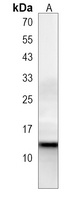 HBG2 Rabbit Polyclonal Antibody