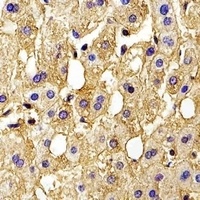 HBG2 Rabbit Polyclonal Antibody