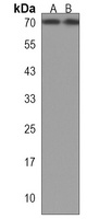 MPP7 Rabbit Polyclonal Antibody