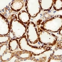 MPP7 Rabbit Polyclonal Antibody