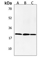 ANP32E Rabbit Polyclonal Antibody