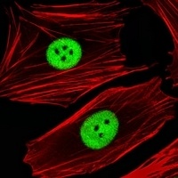 ANP32E Rabbit Polyclonal Antibody
