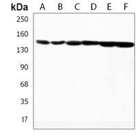 Plakophilin 4 Rabbit Polyclonal Antibody