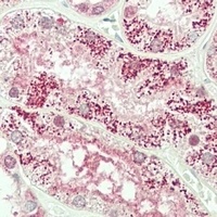 Plakophilin 4 Rabbit Polyclonal Antibody