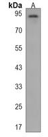 Matrilin 2 Rabbit Polyclonal Antibody