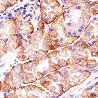 Matrilin 2 Rabbit Polyclonal Antibody