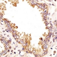 ZRSR2 Rabbit Polyclonal Antibody