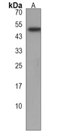 GTDC1 Rabbit Polyclonal Antibody