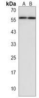IGSF21 Rabbit Polyclonal Antibody