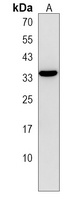 FAM26F Rabbit Polyclonal Antibody