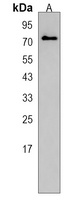 MEX3C Rabbit Polyclonal Antibody
