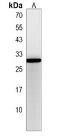 RGS2 Rabbit Polyclonal Antibody