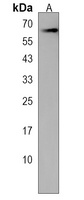CHRNB4 Rabbit Polyclonal Antibody