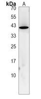 LRRC19 Rabbit Polyclonal Antibody