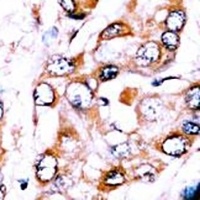 ZNF395 Rabbit Polyclonal Antibody