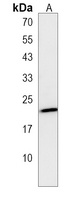 LIN7B Rabbit Polyclonal Antibody