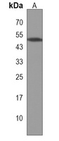 MBOAT7 Rabbit Polyclonal Antibody