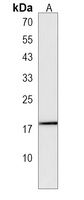 MYL12B Rabbit Polyclonal Antibody