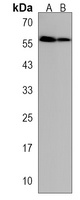 GXYLT2 Rabbit Polyclonal Antibody