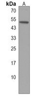 GTPBP3 Rabbit Polyclonal Antibody