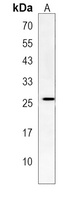 TFEC Rabbit Polyclonal Antibody