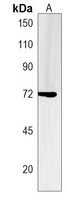 ZNF251 Rabbit Polyclonal Antibody