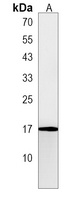 PLAC1 Rabbit Polyclonal Antibody