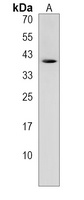 CTRB1 Rabbit Polyclonal Antibody