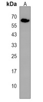 ASIC3 Rabbit Polyclonal Antibody