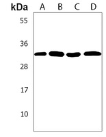 EXOSC6 Rabbit Polyclonal Antibody
