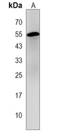 PSG6 Rabbit Polyclonal Antibody