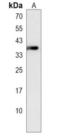 KCTD17 Rabbit Polyclonal Antibody