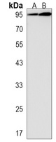 MBD6 Rabbit Polyclonal Antibody