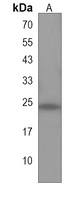 KLRF2 Rabbit Polyclonal Antibody