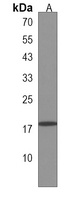 RNF24 Rabbit Polyclonal Antibody