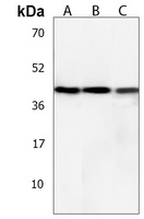 MCIDAS Rabbit Polyclonal Antibody